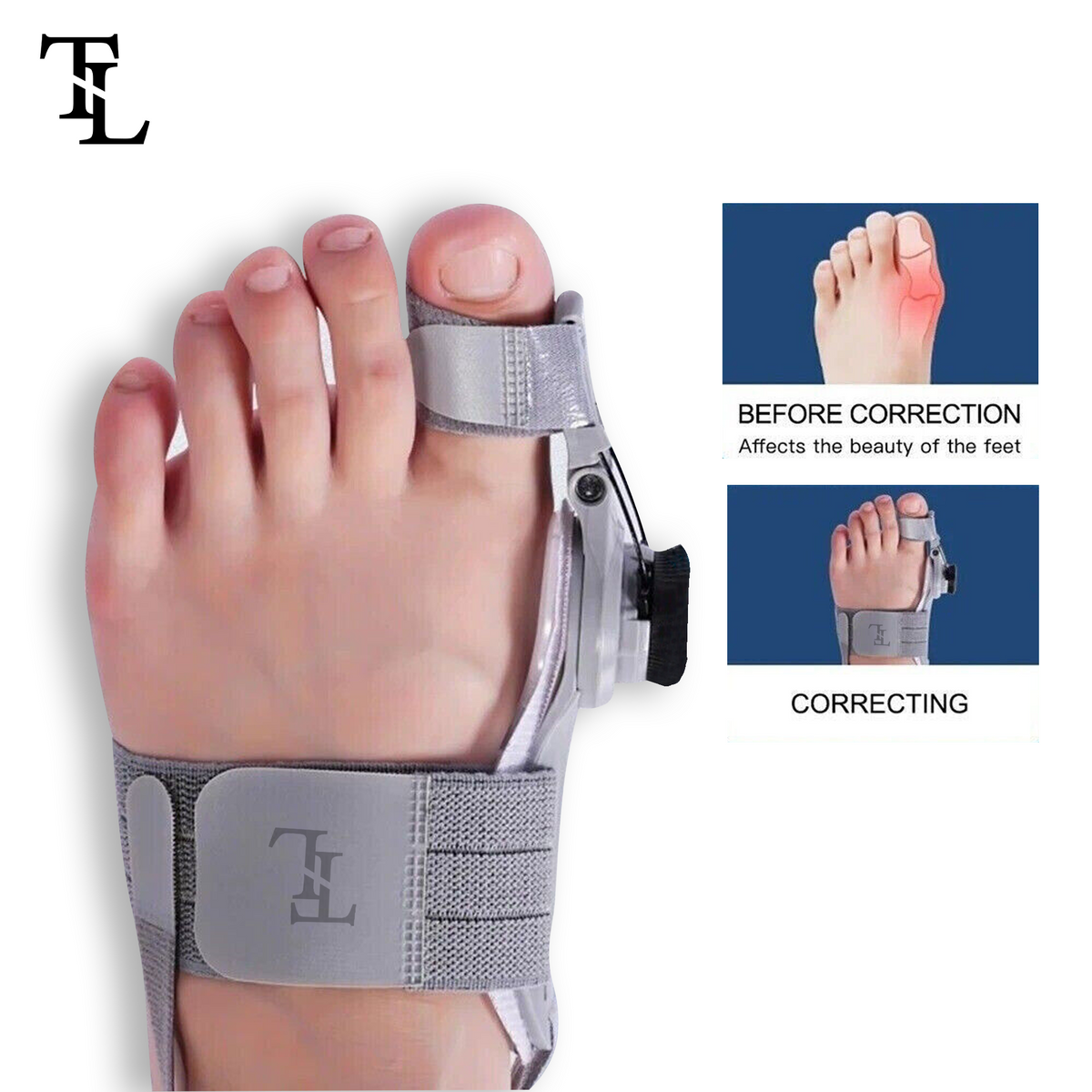 ThriveLuxe™  Bunion Corrector